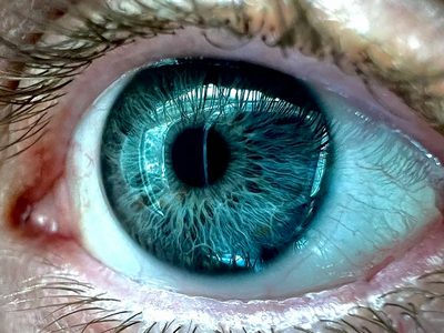 Макрокамера iPhone 13 Pro заменяет дорогое оборудование для проверки глаз